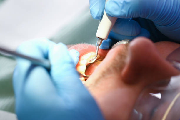 Best Dentist for Tooth Abscess  in Chester, SC