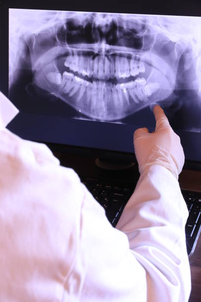 Best Chipped Tooth Repair Near Me  in Chester, SC